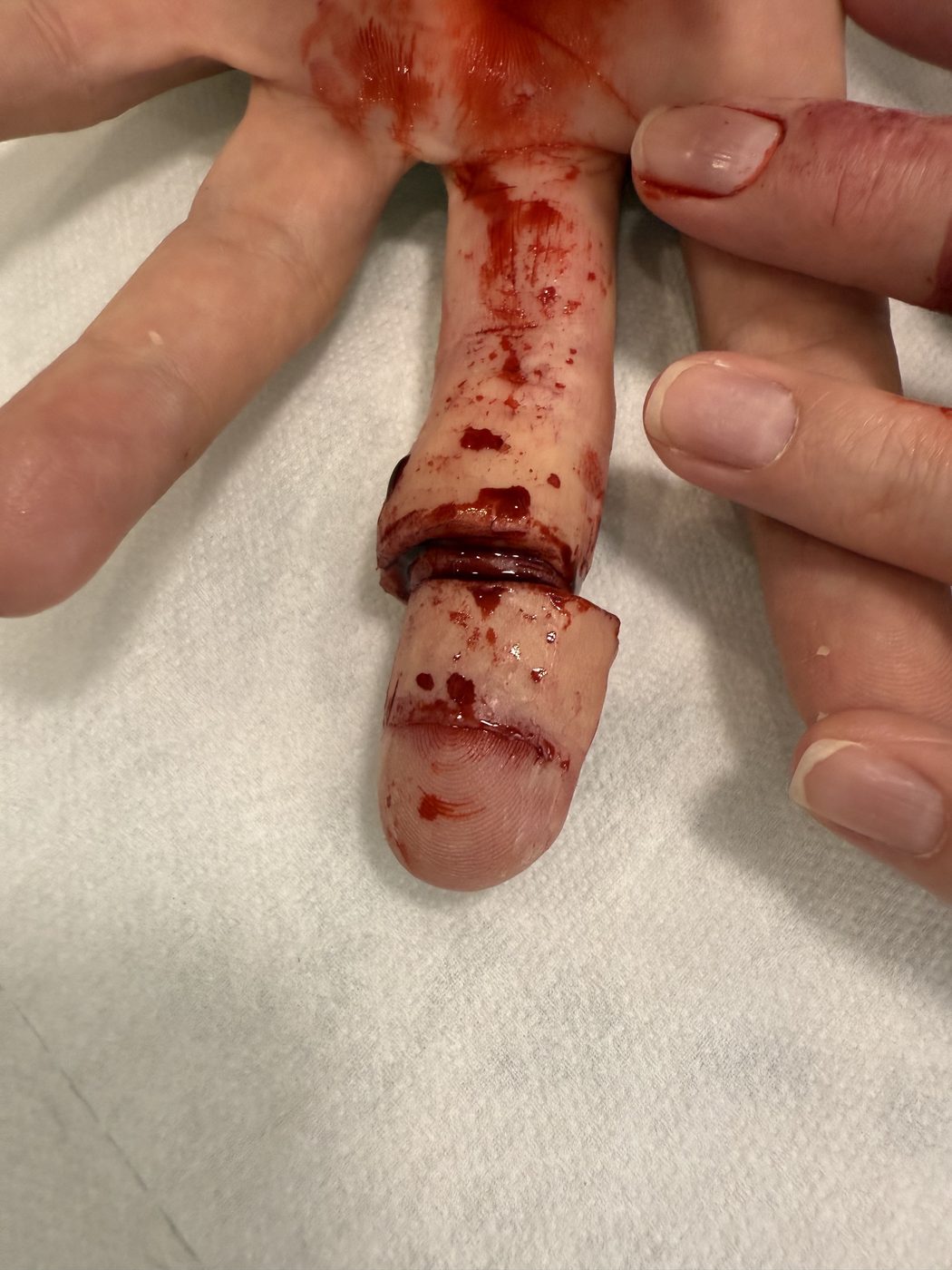 SFX makeup — realistic wound